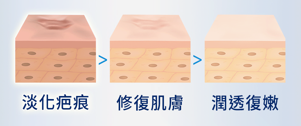可以淡化疤痕、重組肌膚屏障、使肌膚恢復嫩滑