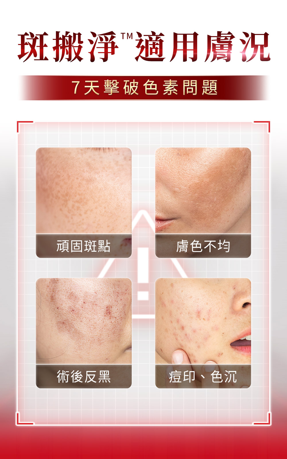 斑點、膚色不均、術後返黑、痘印、色素沉澱