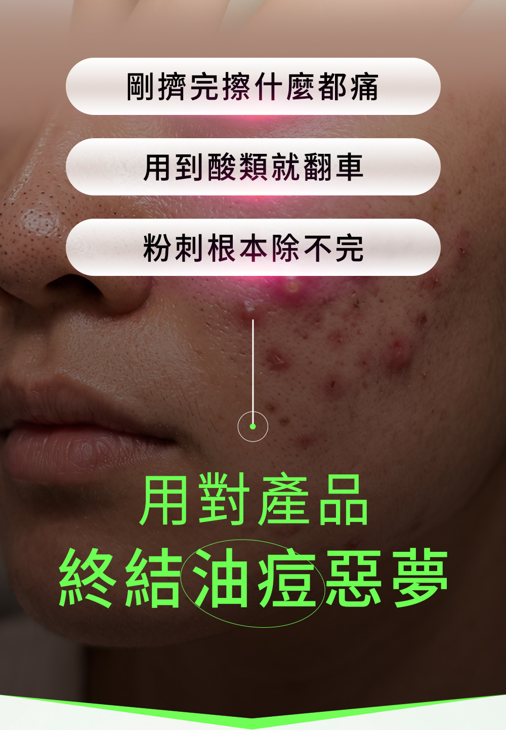 長痘痘、痤瘡