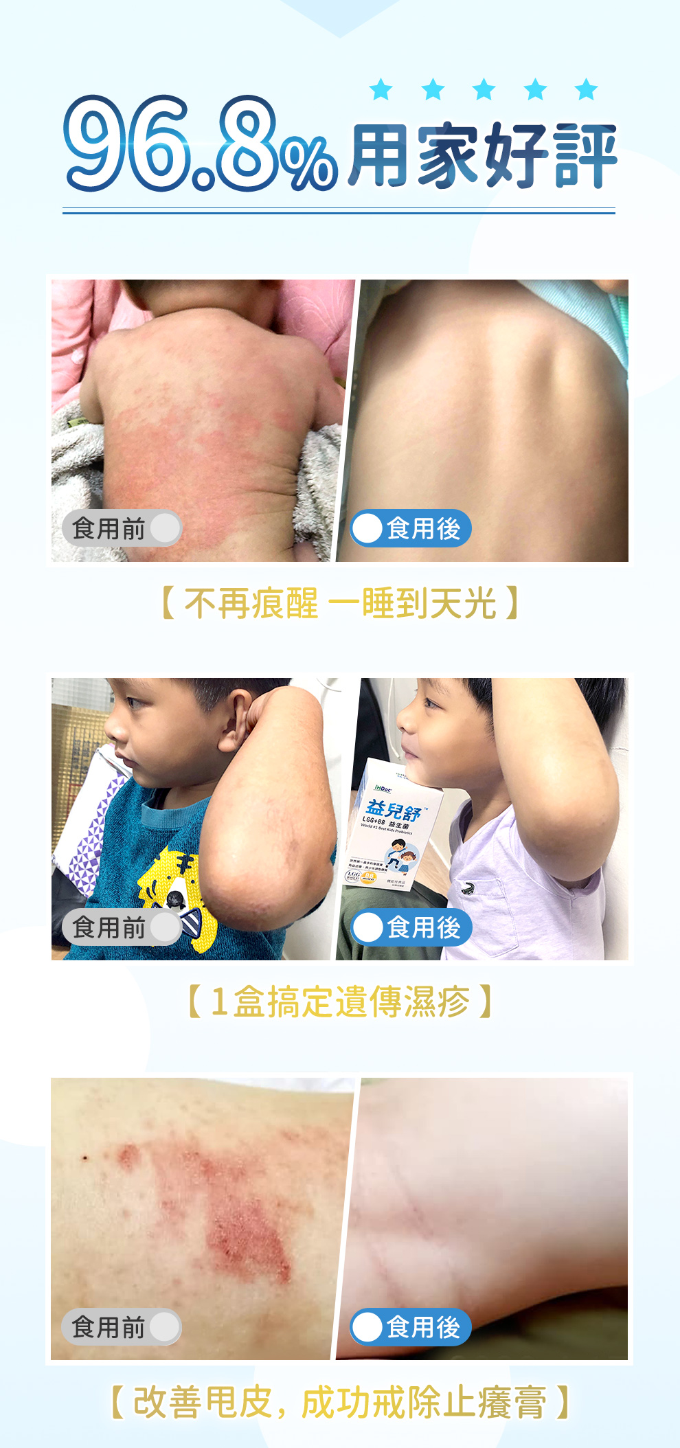 BB、孕婦都可以吃，提早調整體質，預防異位性皮膚炎、濕疹、濕敏