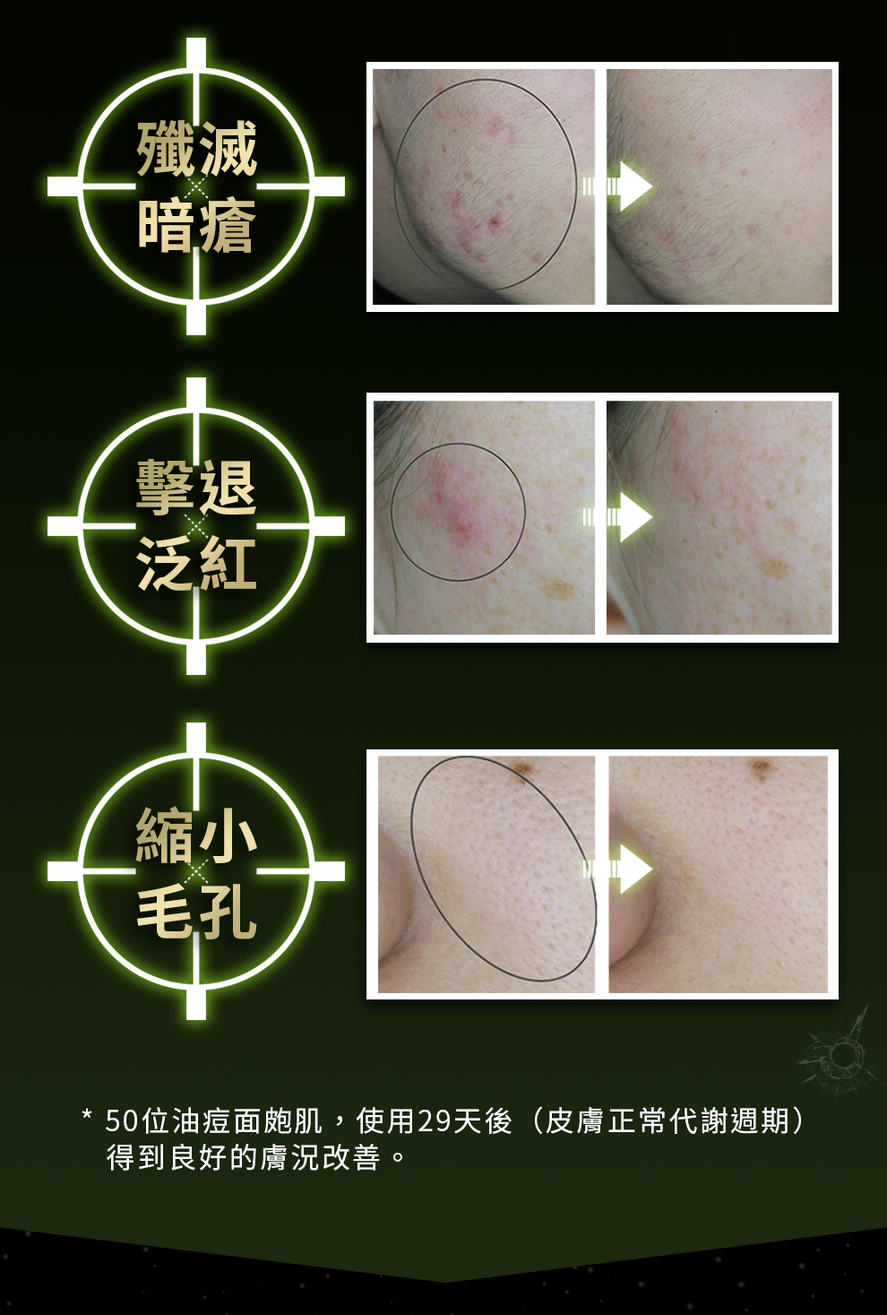 消滅暗瘡、改善泛紅、縮小毛孔