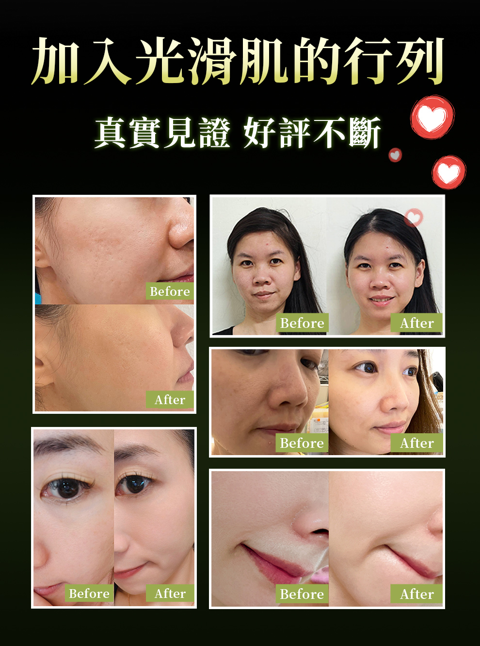 打造無瑕疵美肌