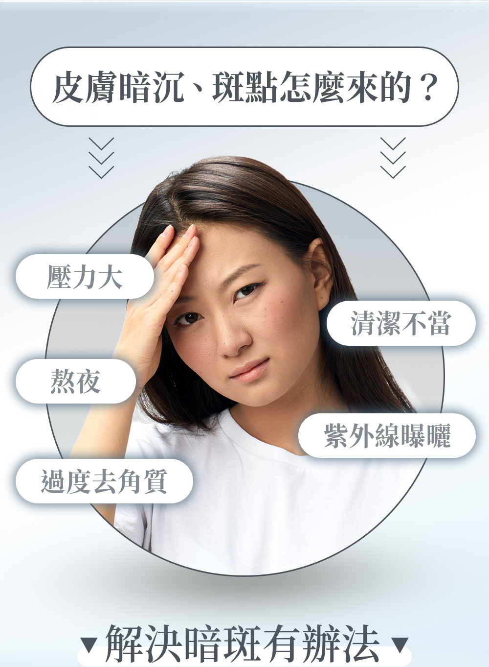 皮膚暗沉、斑點、色素沉澱